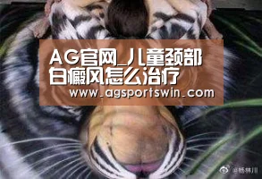 AG官网_儿童颈部白癜风怎么治疗(图1) AG百家乐